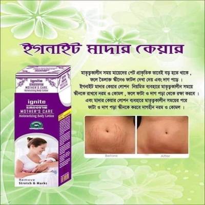 Ignite Mother Care Lotion